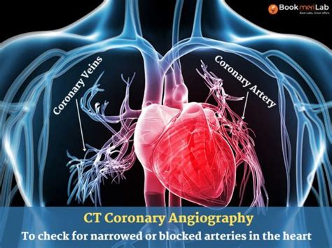 angiogram price in heart center